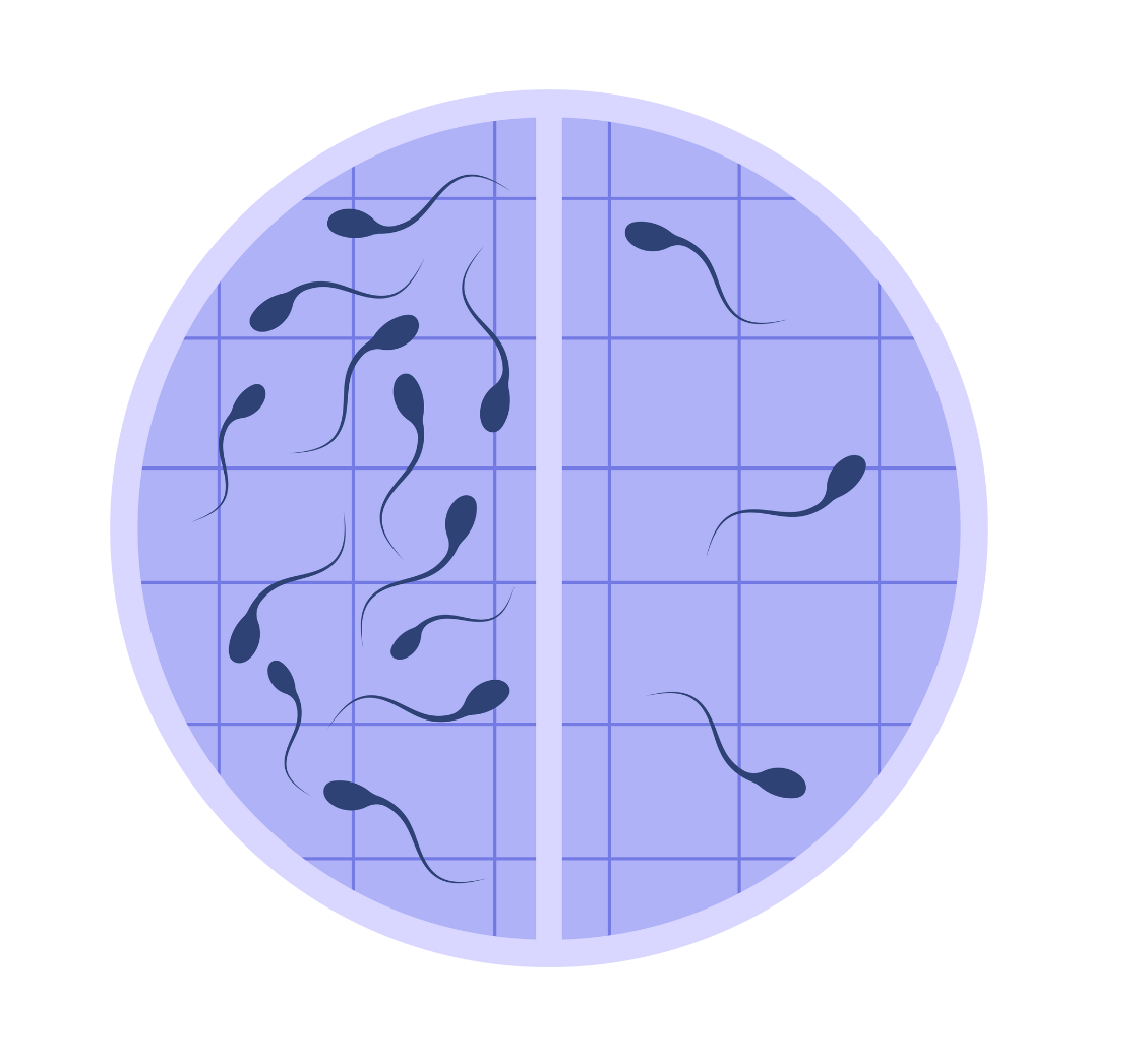 Opt-IVF Technology